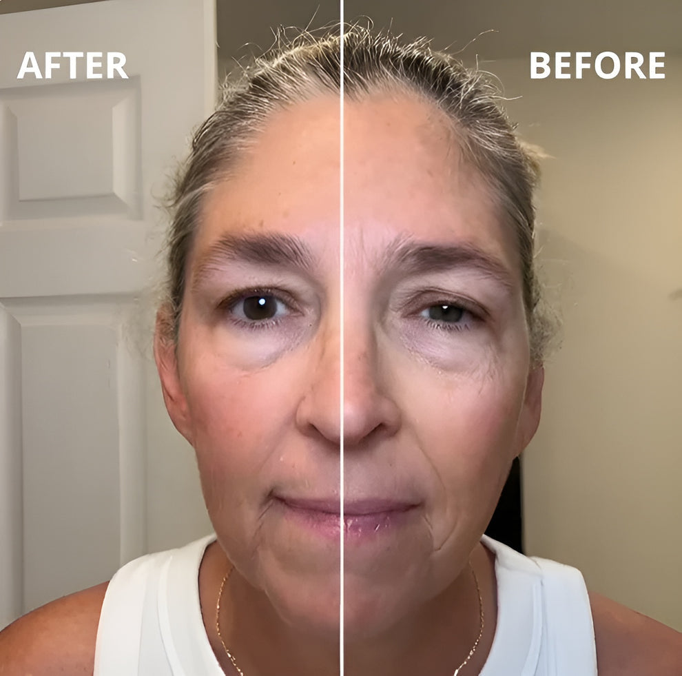 Lymphatic Face Brush